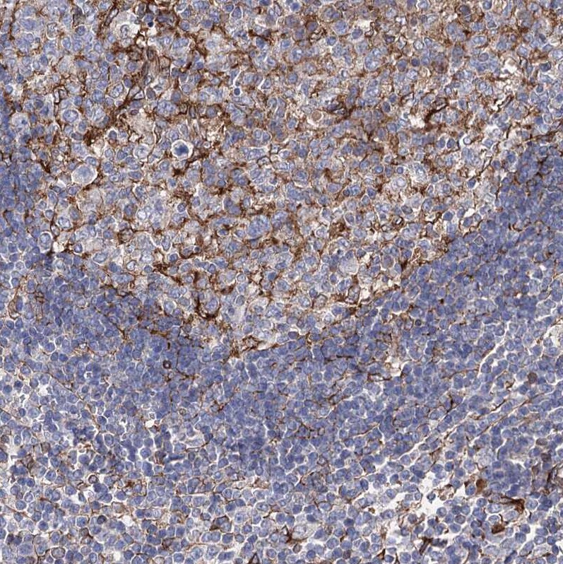 STING/TMEM173 Antibody - BSA Free Immunohistochemistry-Paraffin: STING/TMEM173 Antibody [NBP2-48684]
