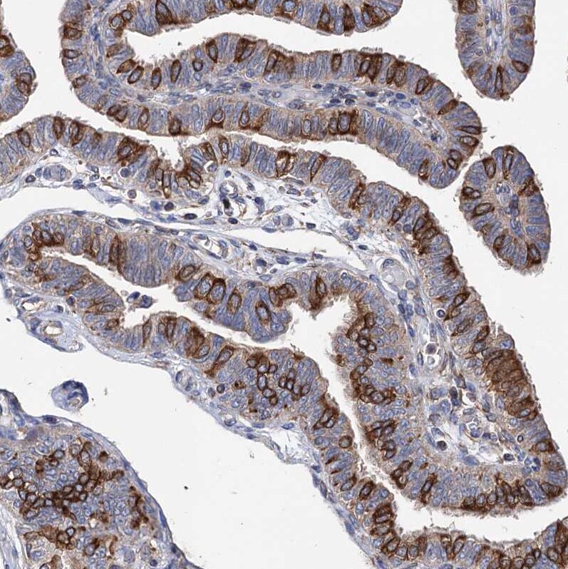 STING/TMEM173 Antibody - BSA Free Immunohistochemistry-Paraffin: STING/TMEM173 Antibody [NBP2-48684]