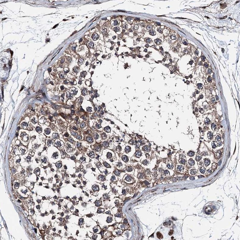 noxin Antibody - BSA Free Immunohistochemistry-Paraffin: noxin Antibody [NBP2-48685]