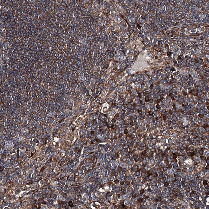 noxin Antibody - BSA Free Immunohistochemistry-Paraffin: noxin Antibody [NBP2-48685]