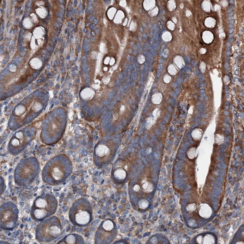 noxin Antibody - BSA Free Immunohistochemistry-Paraffin: noxin Antibody [NBP2-48685]