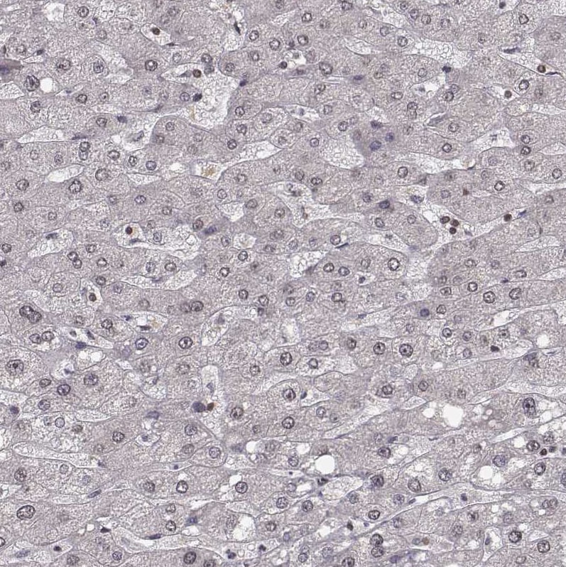 HMGA2 Antibody - BSA Free Immunohistochemistry: HMGA2 Antibody - BSA Free [NBP2-48699]