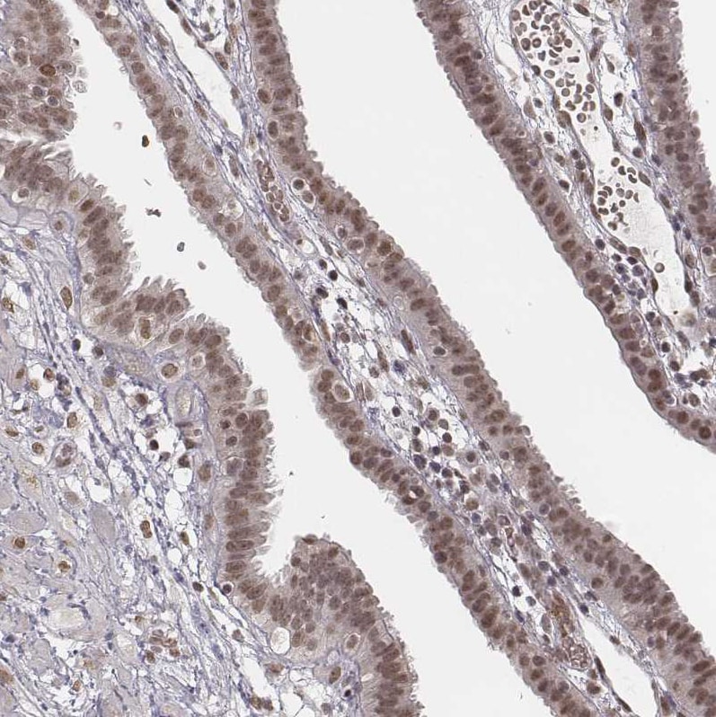 HMGA2 Antibody - BSA Free Immunohistochemistry: HMGA2 Antibody - BSA Free [NBP2-48699]