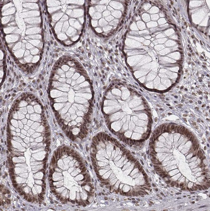 HMGA2 Antibody - BSA Free Immunohistochemistry: HMGA2 Antibody - BSA Free [NBP2-48699]