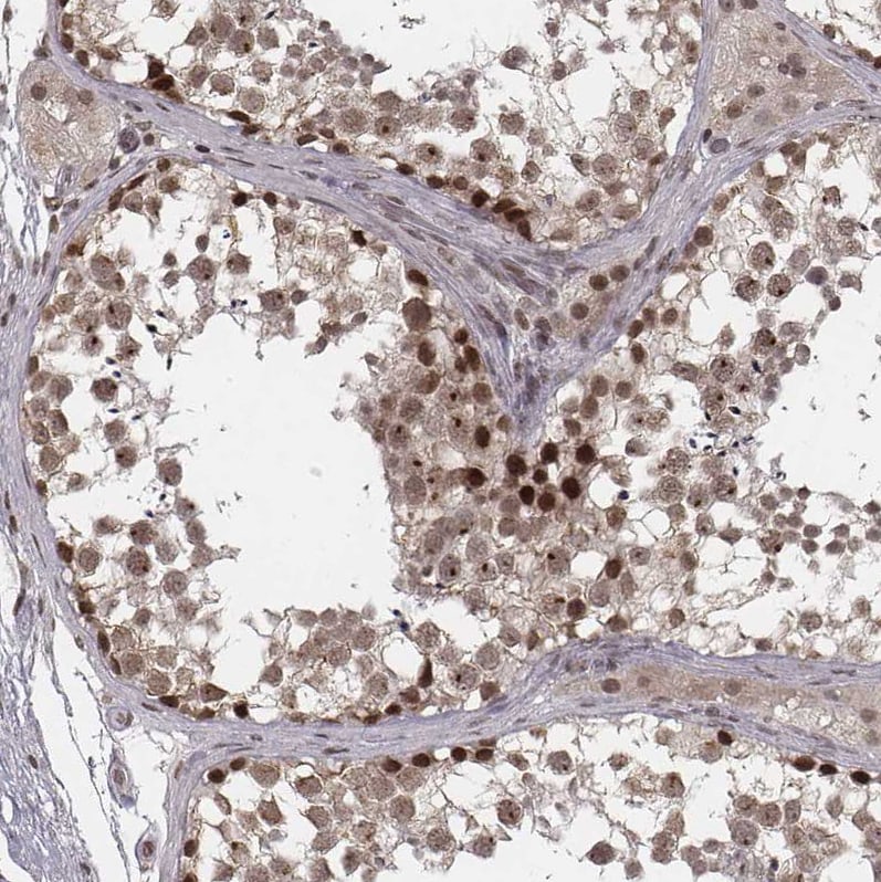 HMGA2 Antibody - BSA Free Immunohistochemistry: HMGA2 Antibody - BSA Free [NBP2-48699]