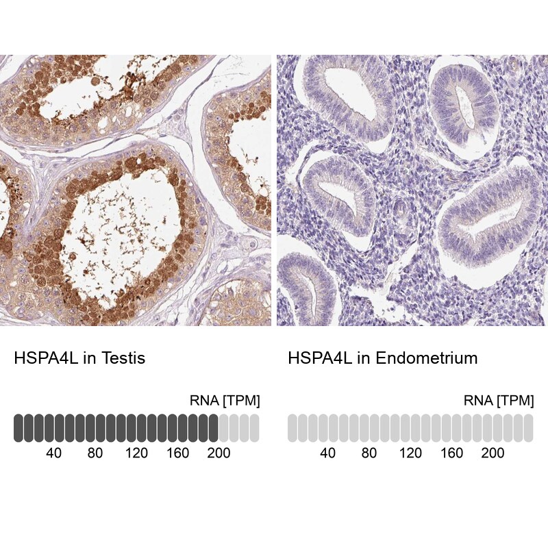HspA4L Antibody - BSA Free Immunohistochemistry-Paraffin: HspA4L Antibody [NBP2-48700]