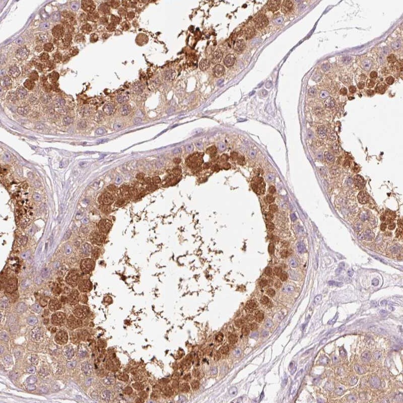 HspA4L Antibody - BSA Free Immunohistochemistry-Paraffin: HspA4L Antibody [NBP2-48700]