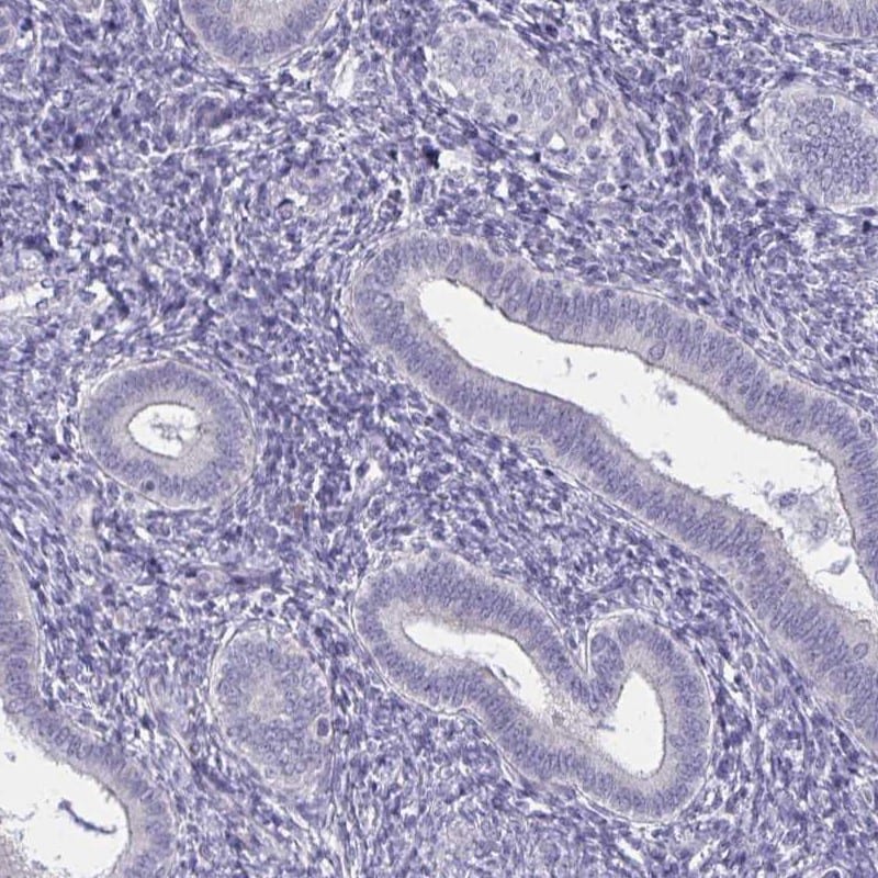 Spectrin beta 3 Antibody - BSA Free Immunohistochemistry-Paraffin: Spectrin beta 3 Antibody [NBP2-48703]