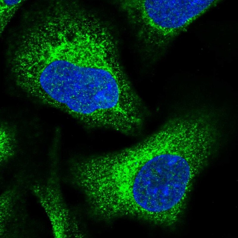 DNAJC3 Antibody - BSA Free Immunocytochemistry/ Immunofluorescence: DNAJC3 Antibody [NBP2-48704]