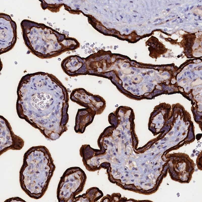PACSIN3 Antibody - BSA Free Immunohistochemistry-Paraffin: PACSIN3 Antibody [NBP2-48707]
