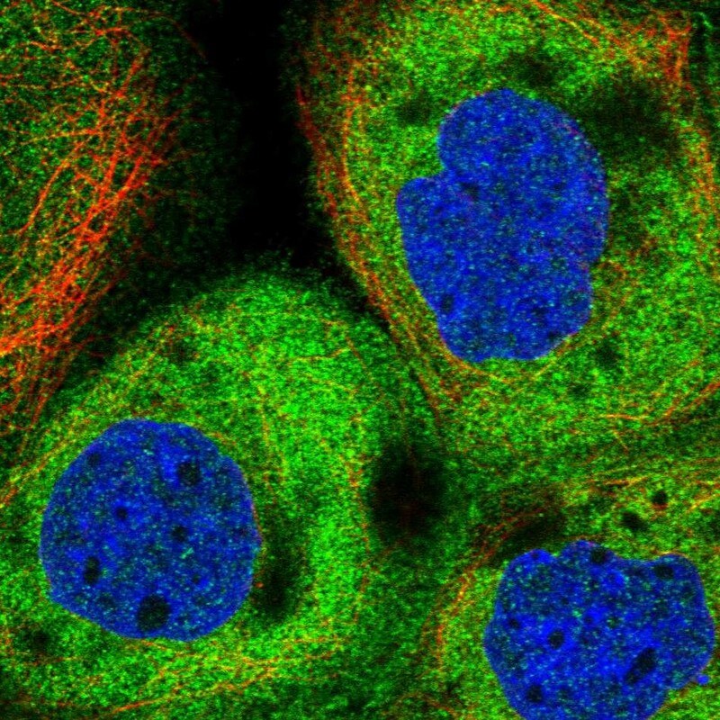CIP2A Antibody - BSA Free Immunocytochemistry/ Immunofluorescence: CIP2A Antibody [NBP2-48710]