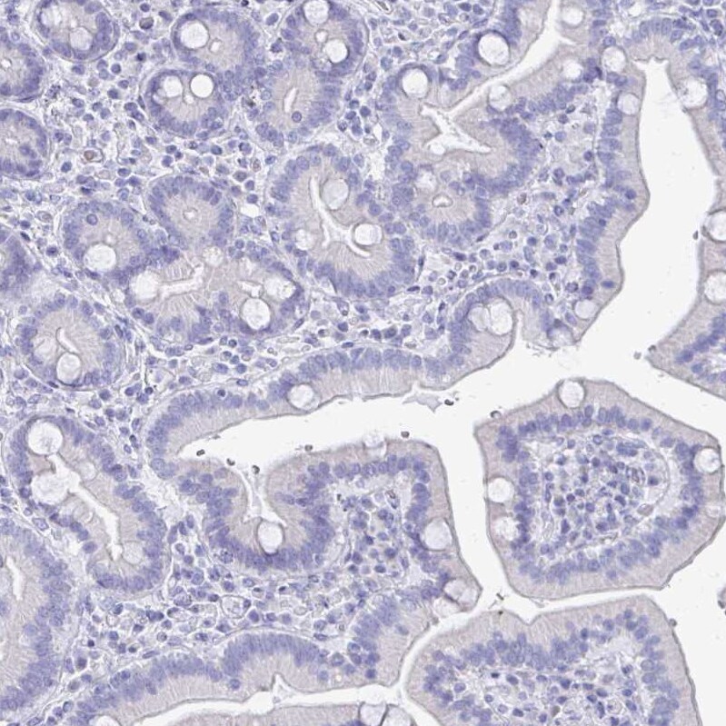 SCP3/SYCP3 Antibody - BSA Free Immunohistochemistry-Paraffin: SCP3/SYCP3 Antibody [NBP2-48713]