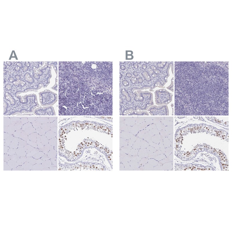 SCP3/SYCP3 Antibody - BSA Free Immunohistochemistry-Paraffin: SCP3/SYCP3 Antibody [NBP2-48713]