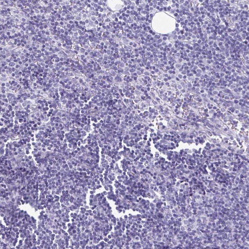 SCP3/SYCP3 Antibody - BSA Free Immunohistochemistry-Paraffin: SCP3/SYCP3 Antibody [NBP2-48713]