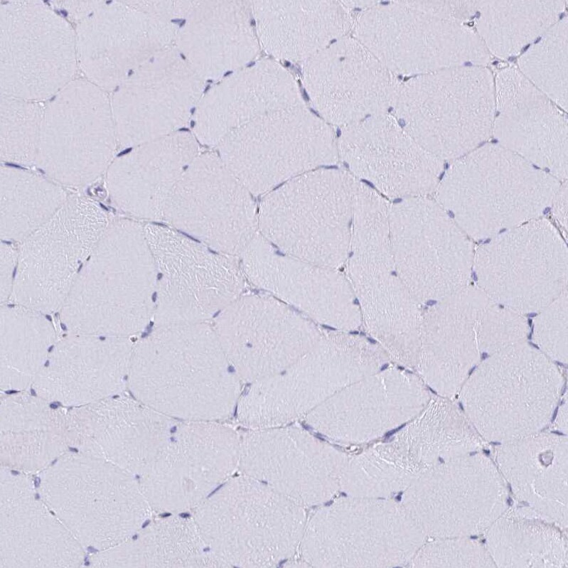 SCP3/SYCP3 Antibody - BSA Free Immunohistochemistry-Paraffin: SCP3/SYCP3 Antibody [NBP2-48713]