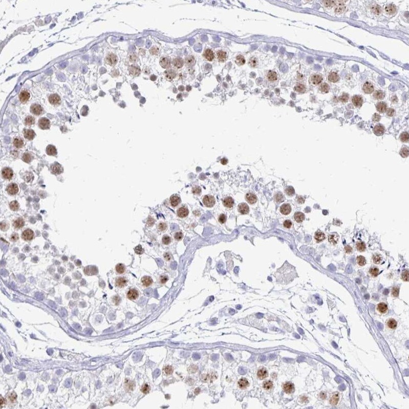 SCP3/SYCP3 Antibody - BSA Free Immunohistochemistry-Paraffin: SCP3/SYCP3 Antibody [NBP2-48713]