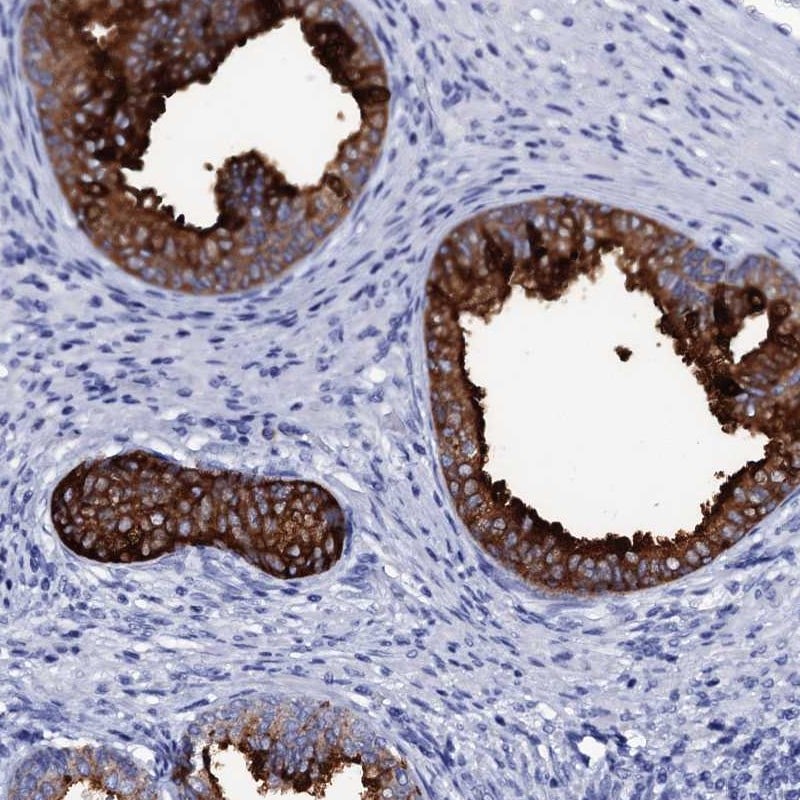 SSFA2 Antibody - BSA Free Immunohistochemistry: SSFA2 Antibody - BSA Free [NBP2-48718]