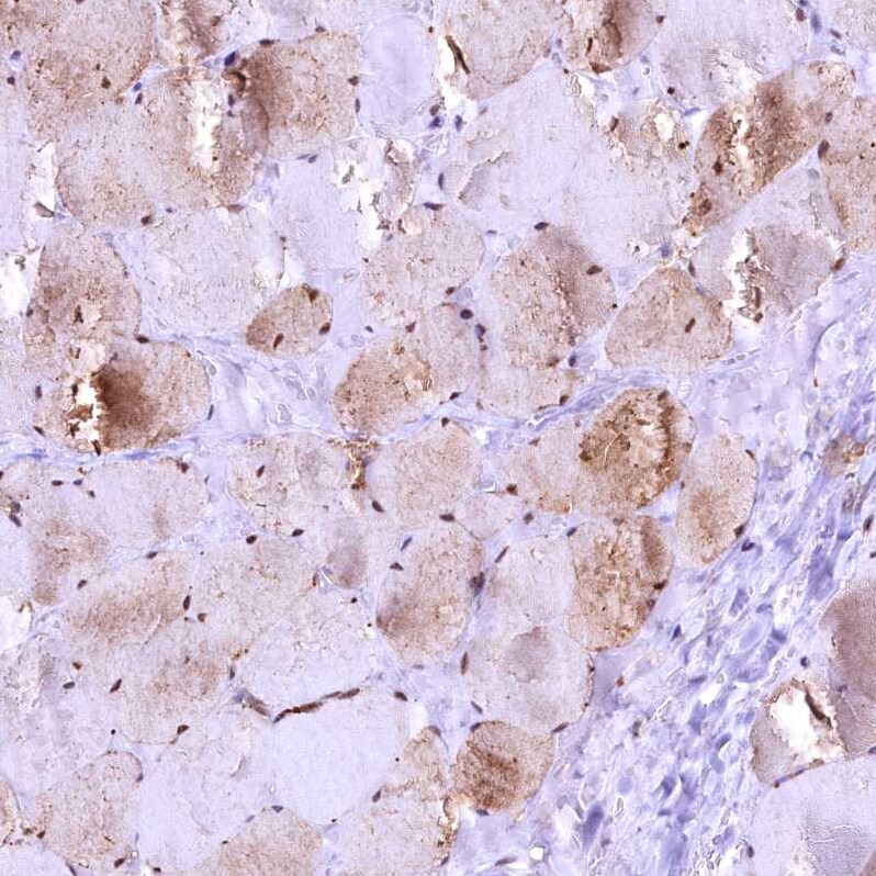 GAPDH Antibody - BSA Free Immunohistochemistry-Paraffin: GAPDH Antibody [NBP2-48721]