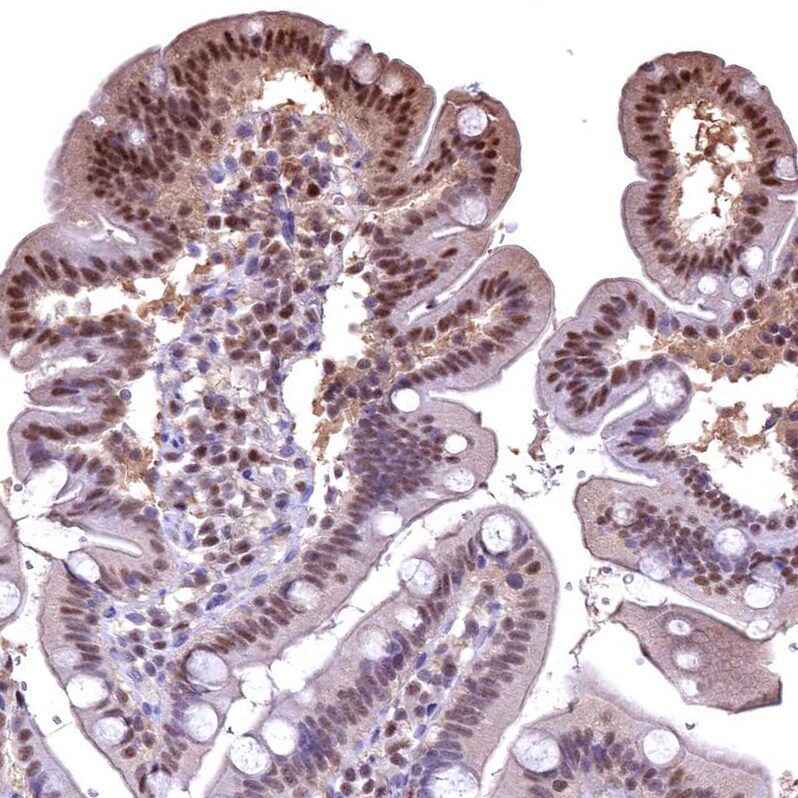 GAPDH Antibody - BSA Free Immunohistochemistry-Paraffin: GAPDH Antibody [NBP2-48721]