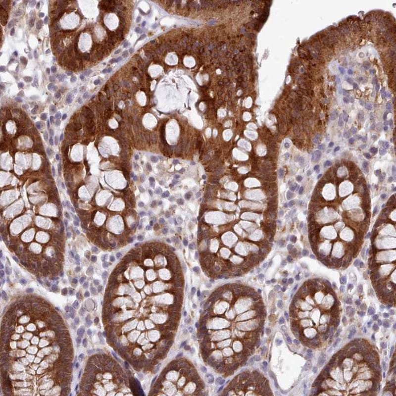 Carboxylesterase 3/CES3/Esterase 31 Antibody - BSA Free Immunohistochemistry: Carboxylesterase 3/CES3/Esterase 31 Antibody - BSA Free [NBP2-48728]