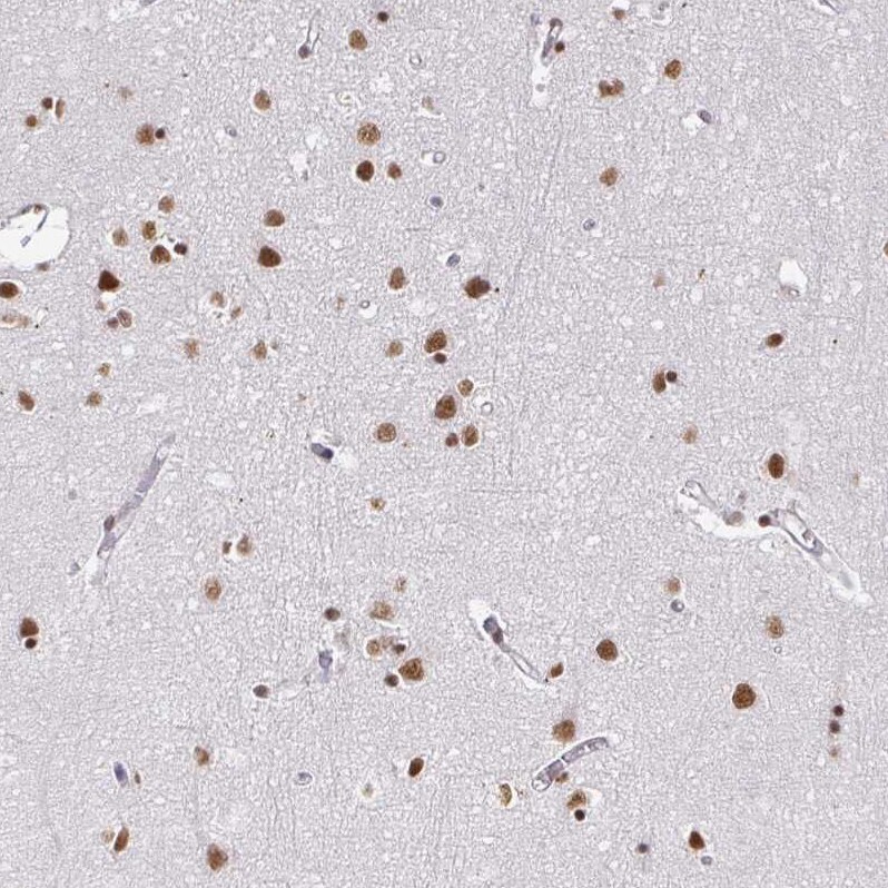 hnRNP U Antibody - BSA Free Immunohistochemistry: hnRNP U Antibody - BSA Free [NBP2-48729]