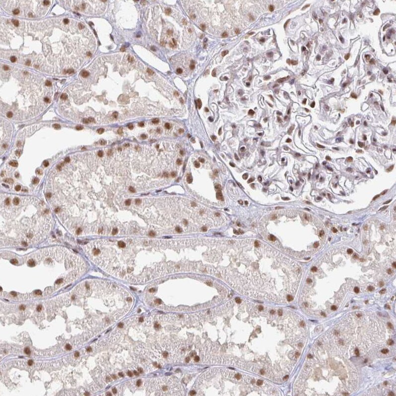 hnRNP U Antibody - BSA Free Immunohistochemistry: hnRNP U Antibody - BSA Free [NBP2-48729]