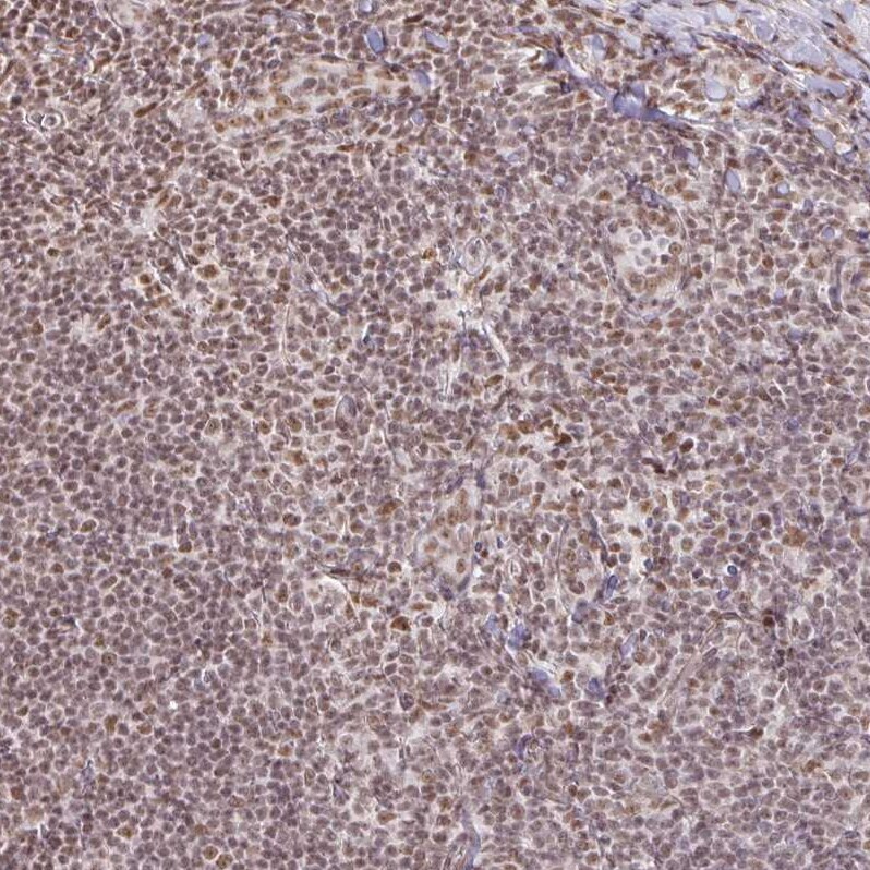 hnRNP U Antibody - BSA Free Immunohistochemistry: hnRNP U Antibody - BSA Free [NBP2-48729]
