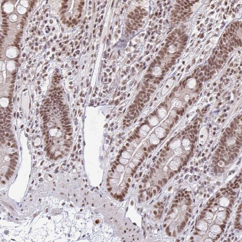 hnRNP U Antibody - BSA Free Immunohistochemistry: hnRNP U Antibody - BSA Free [NBP2-48729]