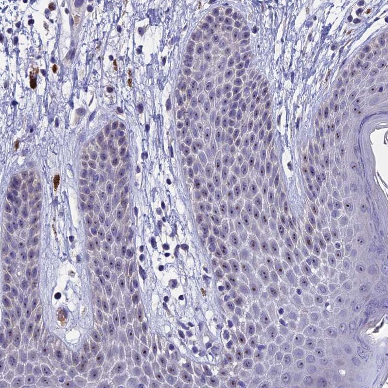 KNOP1 Antibody - BSA Free Immunohistochemistry-Paraffin: KNOP1 Antibody [NBP2-48730]