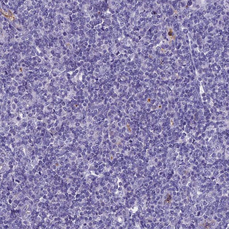KNOP1 Antibody - BSA Free Immunohistochemistry-Paraffin: KNOP1 Antibody [NBP2-48730]