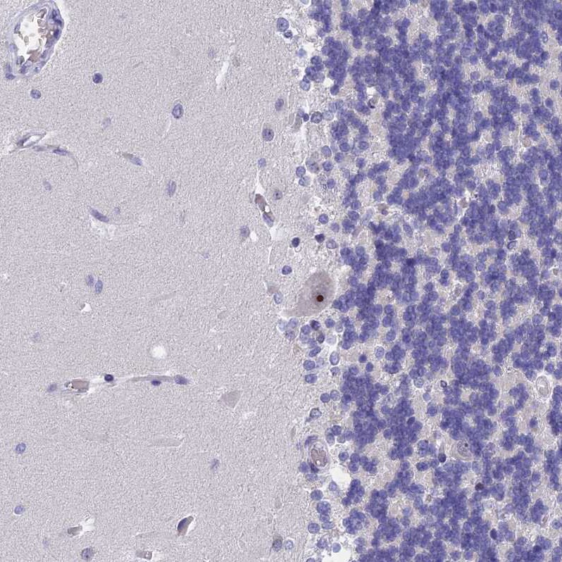 KNOP1 Antibody - BSA Free Immunohistochemistry-Paraffin: KNOP1 Antibody [NBP2-48730]
