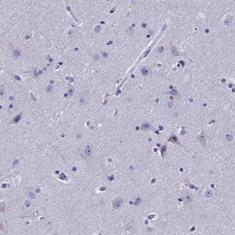 KNOP1 Antibody - BSA Free Immunohistochemistry-Paraffin: KNOP1 Antibody [NBP2-48730]