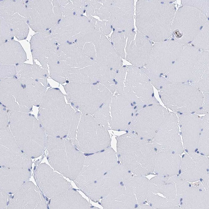 CYP51A1 Antibody - BSA Free Immunohistochemistry-Paraffin: CYP51A1 Antibody [NBP2-48733]