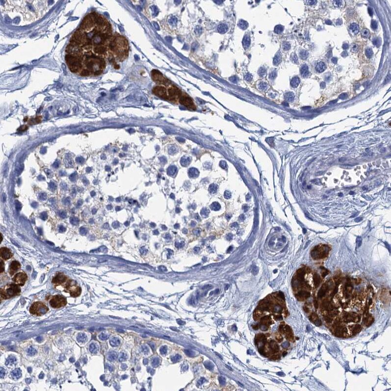 CYP51A1 Antibody - BSA Free Immunohistochemistry-Paraffin: CYP51A1 Antibody [NBP2-48733]