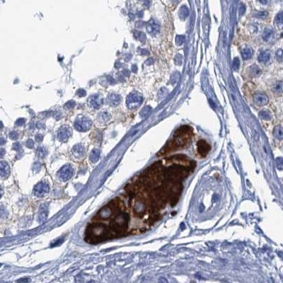 CYP51A1 Antibody - BSA Free Immunohistochemistry-Paraffin: CYP51A1 Antibody [NBP2-48733]