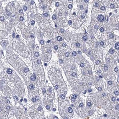 CYP51A1 Antibody - BSA Free Immunohistochemistry-Paraffin: CYP51A1 Antibody [NBP2-48733]