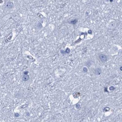 CYP51A1 Antibody - BSA Free Immunohistochemistry-Paraffin: CYP51A1 Antibody [NBP2-48733]