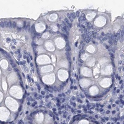 CYP51A1 Antibody - BSA Free Immunohistochemistry-Paraffin: CYP51A1 Antibody [NBP2-48733]