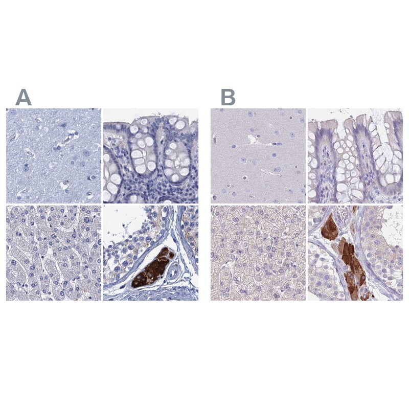 CYP51A1 Antibody - BSA Free Immunohistochemistry-Paraffin: CYP51A1 Antibody [NBP2-48733]