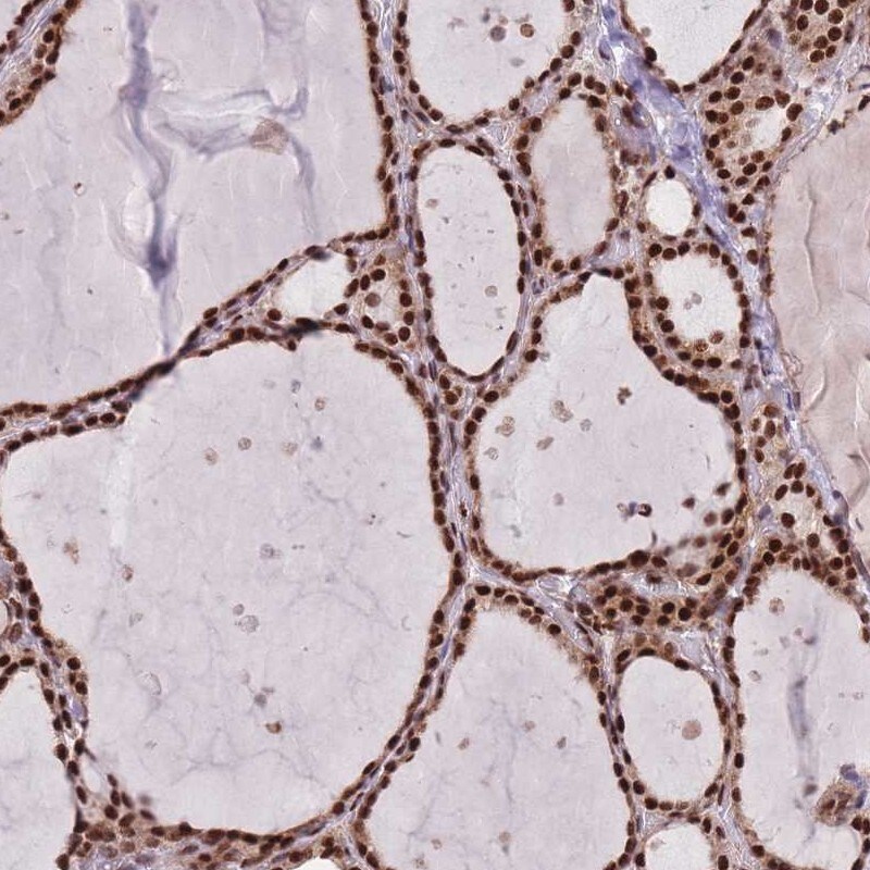 DNAJC3 Antibody - BSA Free Immunohistochemistry-Paraffin: DNAJC3 Antibody [NBP2-48734]