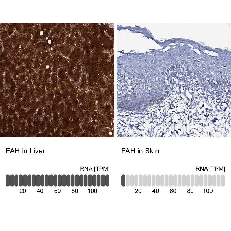 Fumarylacetoacetate hydrolase Antibody - BSA Free Immunohistochemistry-Paraffin: Fumarylacetoacetate hydrolase Antibody [NBP2-48736]