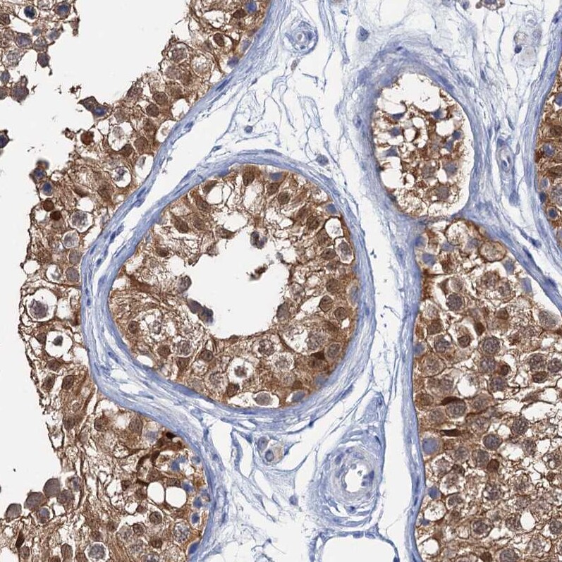 Fumarylacetoacetate hydrolase Antibody - BSA Free Immunohistochemistry-Paraffin: Fumarylacetoacetate hydrolase Antibody [NBP2-48736]