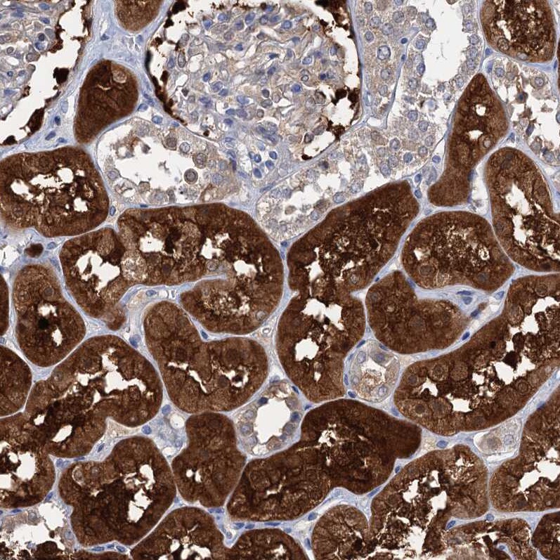 Fumarylacetoacetate hydrolase Antibody - BSA Free Immunohistochemistry-Paraffin: Fumarylacetoacetate hydrolase Antibody [NBP2-48736]