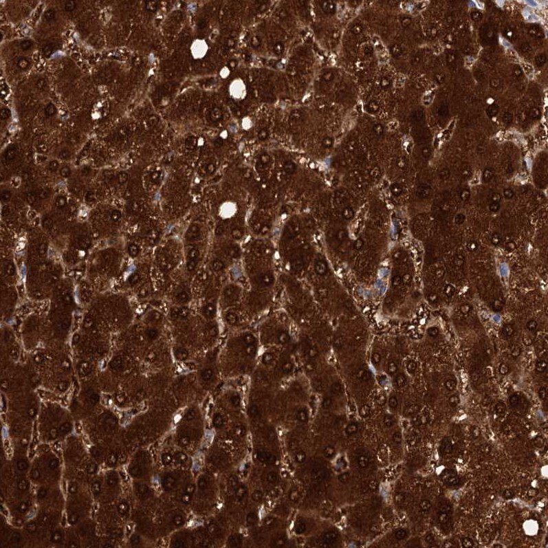 Fumarylacetoacetate hydrolase Antibody - BSA Free Immunohistochemistry-Paraffin: Fumarylacetoacetate hydrolase Antibody [NBP2-48736]
