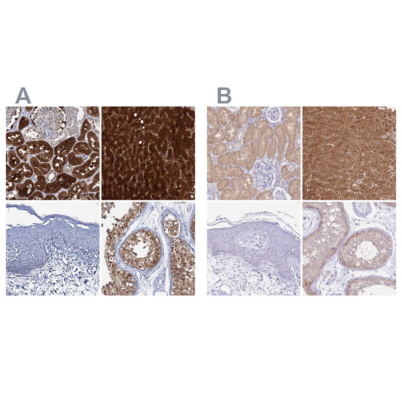 Fumarylacetoacetate hydrolase Antibody - BSA Free Immunohistochemistry-Paraffin: Fumarylacetoacetate hydrolase Antibody [NBP2-48736]