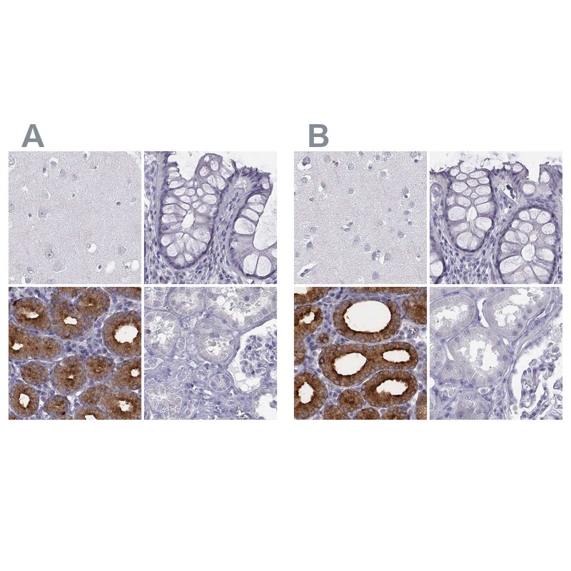C6orf58 Antibody Immunohistochemistry-Paraffin: C6orf58 Antibody Antibody [NBP2-48738]