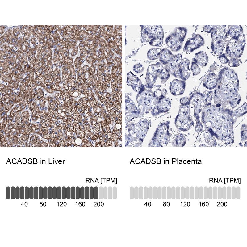 ACADSB Antibody - BSA Free Immunohistochemistry-Paraffin: ACADSB Antibody [NBP2-48739]