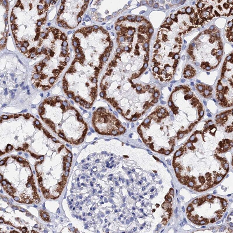ACADSB Antibody - BSA Free Immunohistochemistry-Paraffin: ACADSB Antibody [NBP2-48739]