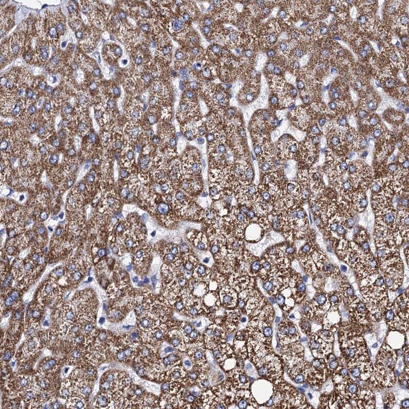 ACADSB Antibody - BSA Free Immunohistochemistry-Paraffin: ACADSB Antibody [NBP2-48739]