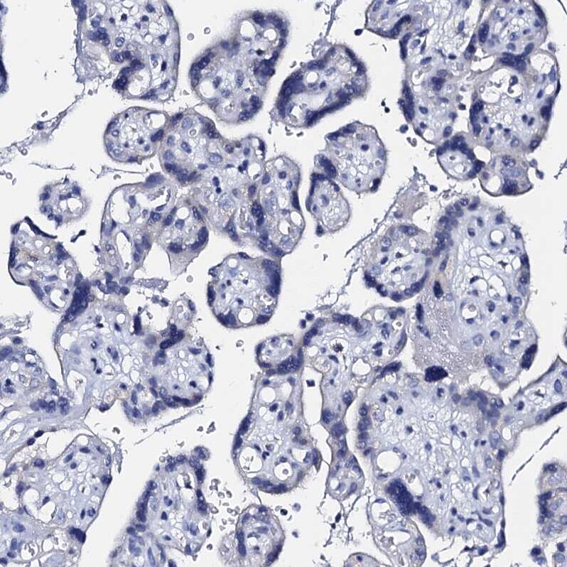 ACADSB Antibody - BSA Free Immunohistochemistry-Paraffin: ACADSB Antibody [NBP2-48739]